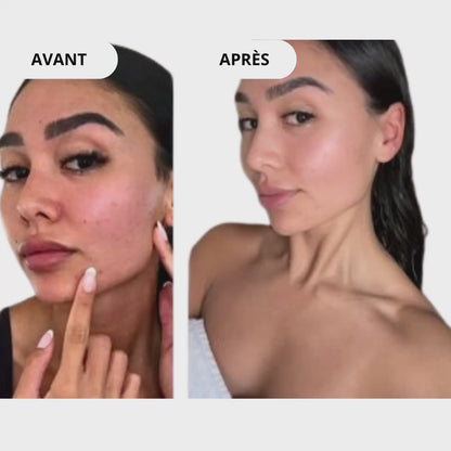 AquaPure Pro™ - Pommeau de douche filtrant - FreshLine®